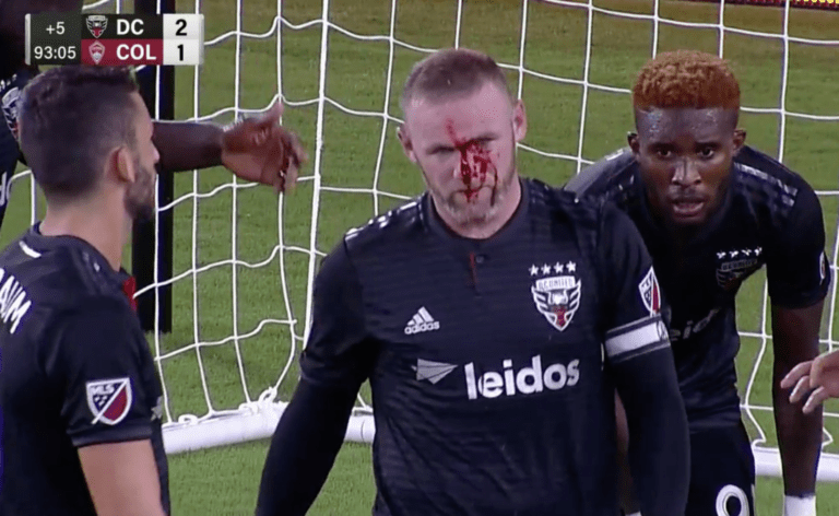 Ο Ρούνεϊ σκόραρε και έσπασε τη μύτη του (pic)