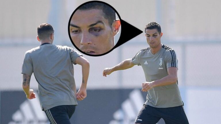 Με μαυρισμένο μάτι στην προπόνηση ο Κ. Ρονάλντο (vid)
