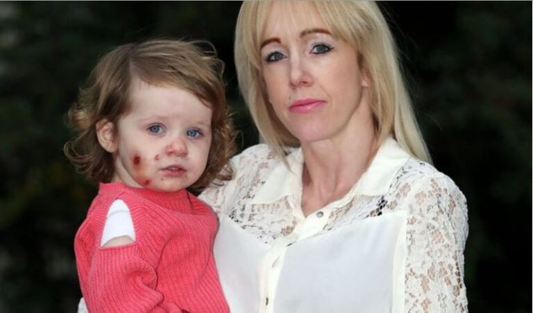 Τρομακτικό: Δάγκωσαν 17 μηνών κοριτσάκι σε παιδότοπο