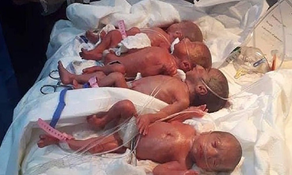 25χρονη γέννησε με φυσιολογικό τοκετό 7 μωρά! 6 κορίτσια και ένα αγόρι