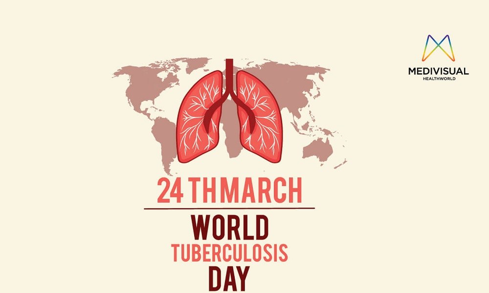 Παγκόσμια ημέρα κατά της φυματίωσης