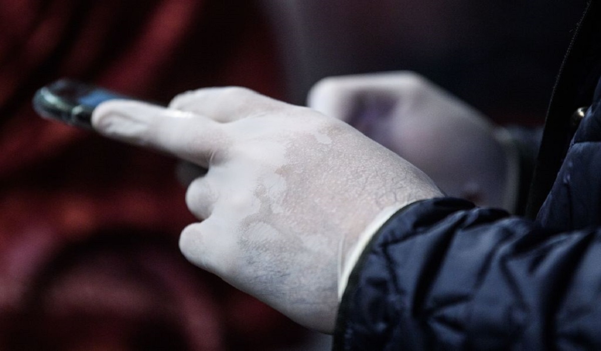 Κορονοϊός: Δείτε πως γίνονται τα χέρια του ιατρικού προσωπικού στην Ιταλία