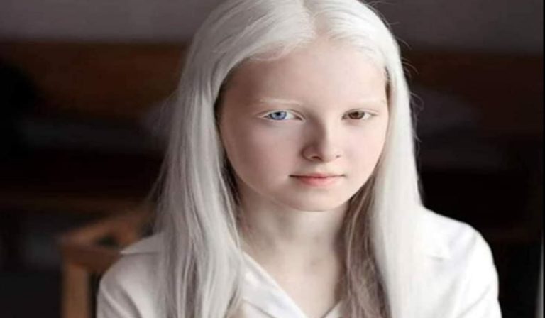 H 11χρονη Τσετσένα με την εξωγήινη εικόνα