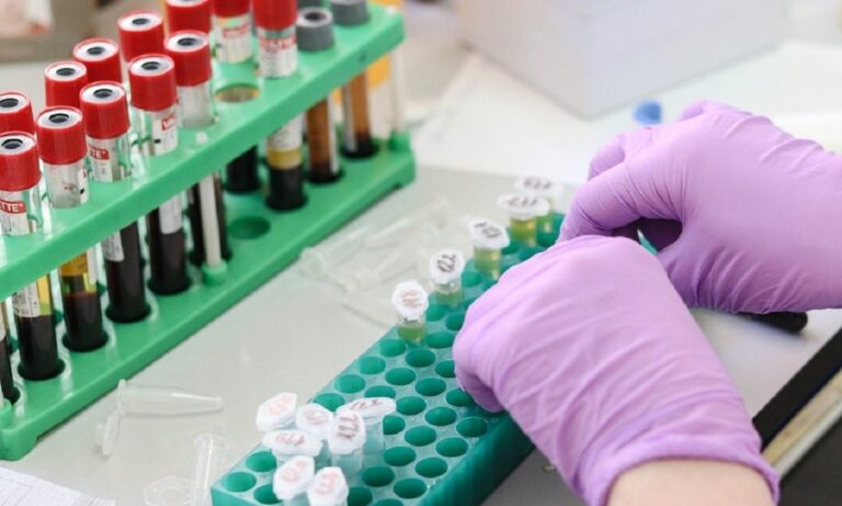 Κορονοϊός: «Εντοπίσαμε αντίσωμα που εξουδετερώνει τον ιό»