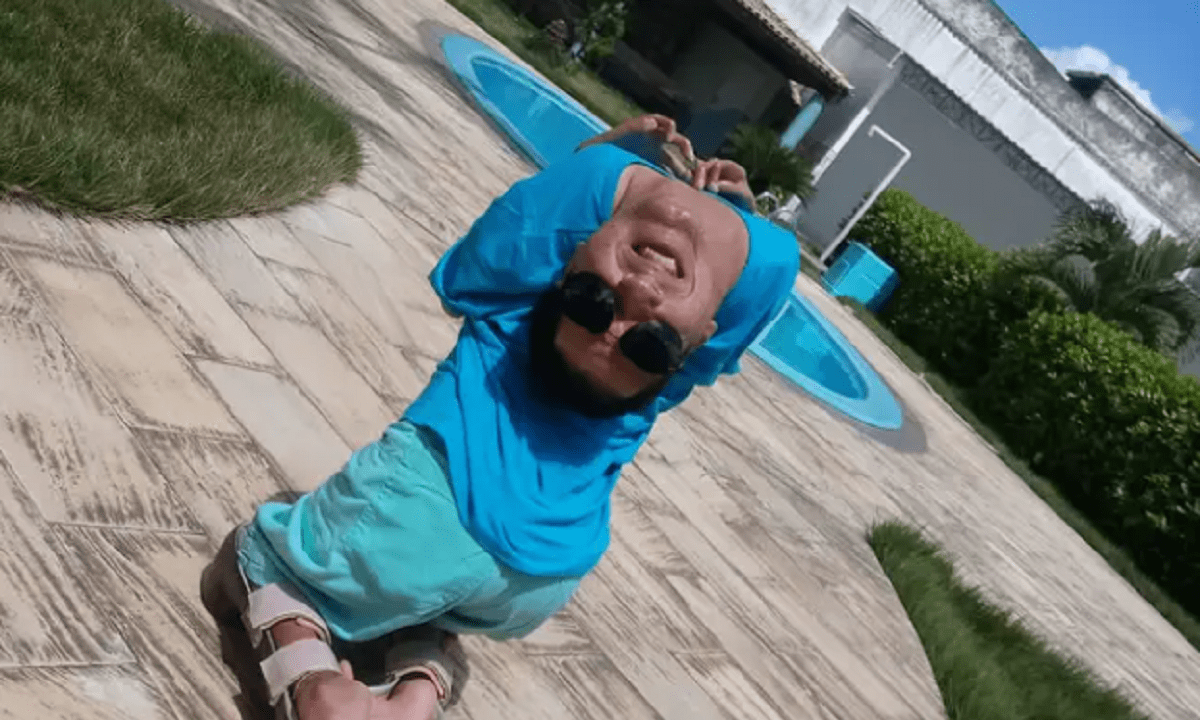 Βραζιλία: Ο άνθρωπος με το ανάποδο κεφάλι ζει την κάθε του στιγμή και εντυπωσιάζει, παρά τις προβλέψεις (pics)