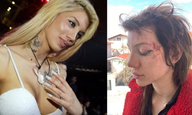 Μαρία Αλεξάνδρου: Άγριος ξυλοδαρμός κατά του μοντέλου από γυναίκες!