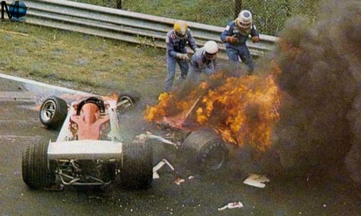 1 Αυγούστου 1976: Το τρομακτικό ατύχημα του Νίκι Λάουντα στην πίστα του Νίρνμπουργκρινγκ (vid)