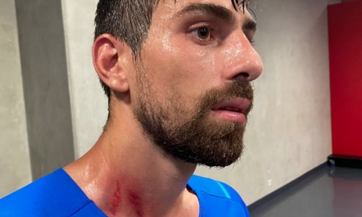 Σοκαριστικές εικόνες από τους τραυματίες παίκτες της Μαρσέιγ μετά το «ντου» των οπαδών της Νις (pics)