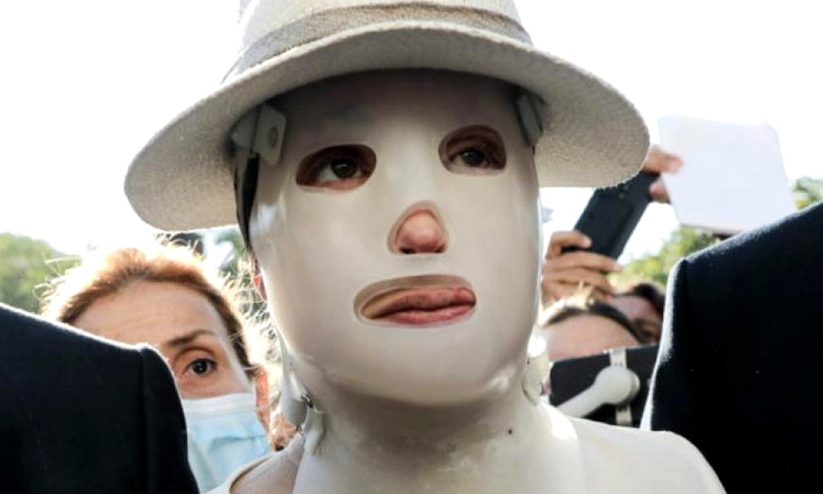 Βιτριόλι: Τι είναι η ειδική μάσκα που φοράει η Ιωάννα Παλιοσπύρου