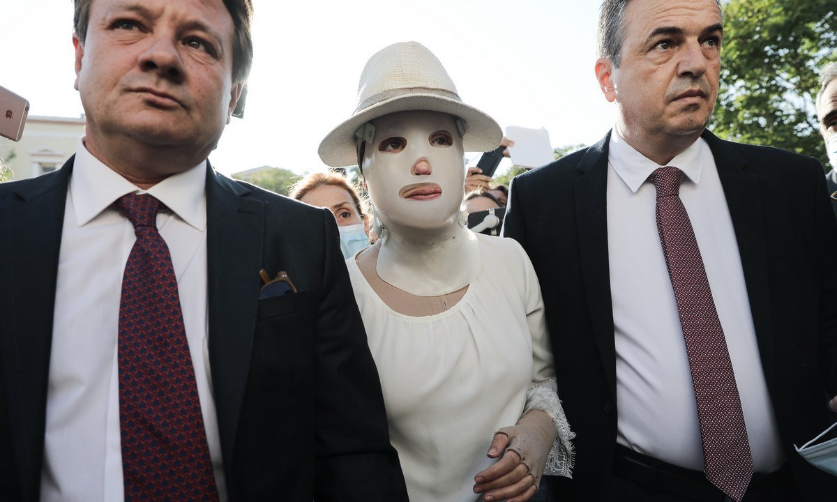 Επίθεση με βιτριόλι: Ο 40χρονος σπάει τη σιωπή του… και φωτογραφίζει 3ο πρόσωπο