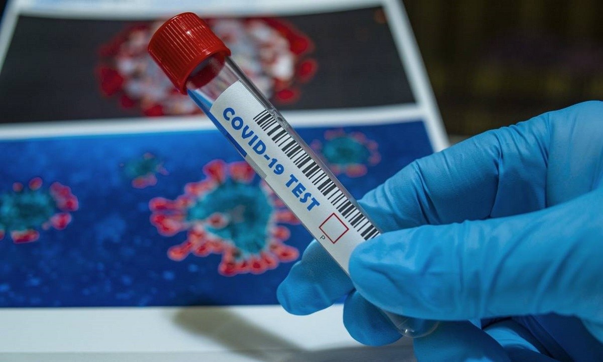 PCR τεστ: Ο Πανελλήνιος Ιατρικός Σύλλογος αδειάζει την κυβέρνηση – «Επικίνδυνη η μείωση της τιμής τους»