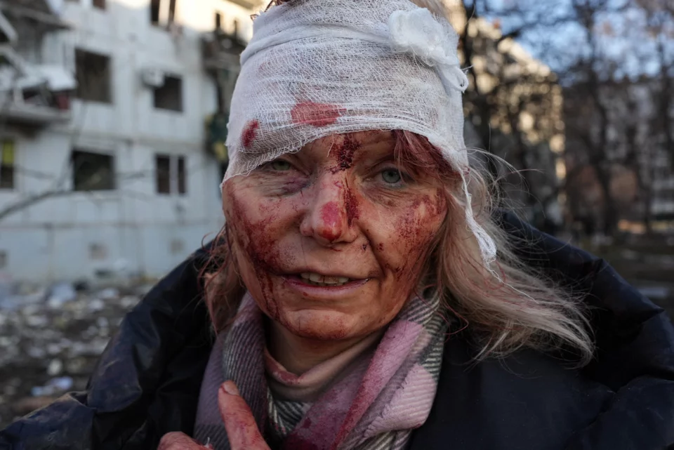 Πόλεμος στην Ουκρανία: Φωτογραφίες και videos από την ζωντανή κόλαση