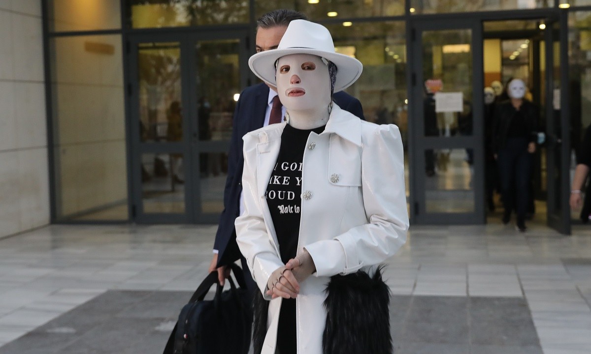 Ιωάννα Παλιοσπύρου: Δύο χρόνια μετά την επίθεση με βιτριόλι, εμφανίζεται μπροστά στο τηλεοπτικό κοινό για πρώτη φορά χωρίς τη μάσκα της.