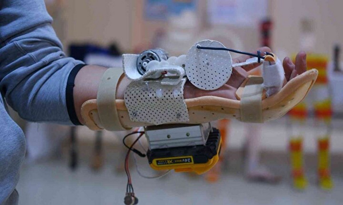 Tουρκία: Επαναστατική συσκευή από φοιτητή – Ελπίδες σε ασθενείς