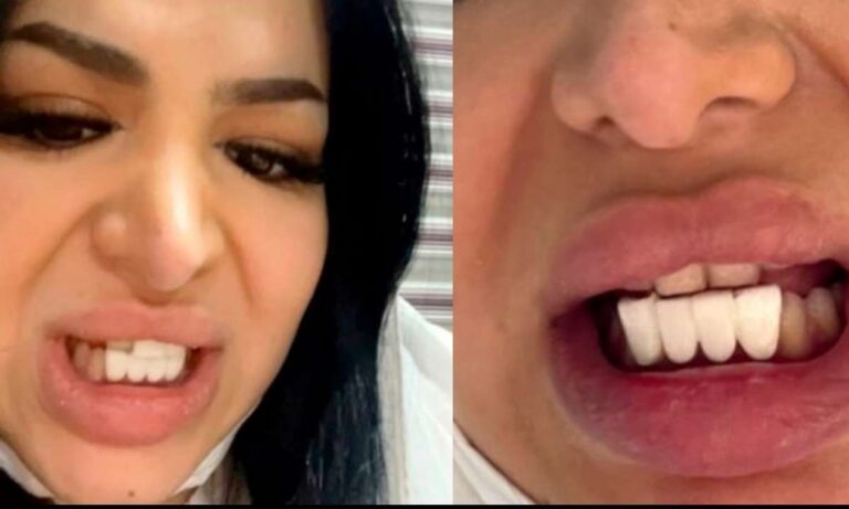 Πήγε σε οδοντίατρο στο Ιράν για πιο φθηνά και δείτε πως την έκανε
