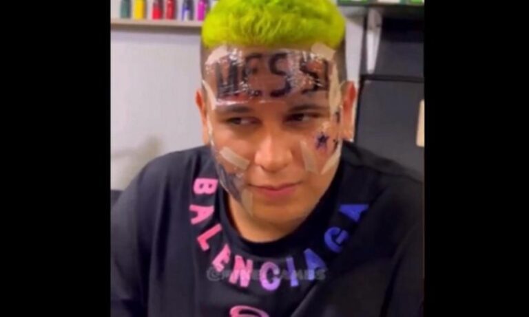 Μέσι – παράνοια: Νεαρός «χτύπησε» τατουάζ στο μέτωπό του το όνομα του Αργεντινού σταρ!
