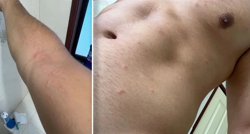 Εμφανίστηκε ο μπλε δράκος στο Αιγαίο: Τρώει ακόμα και τον εαυτό του - Άρπαξε το χέρι ενός παιδιού