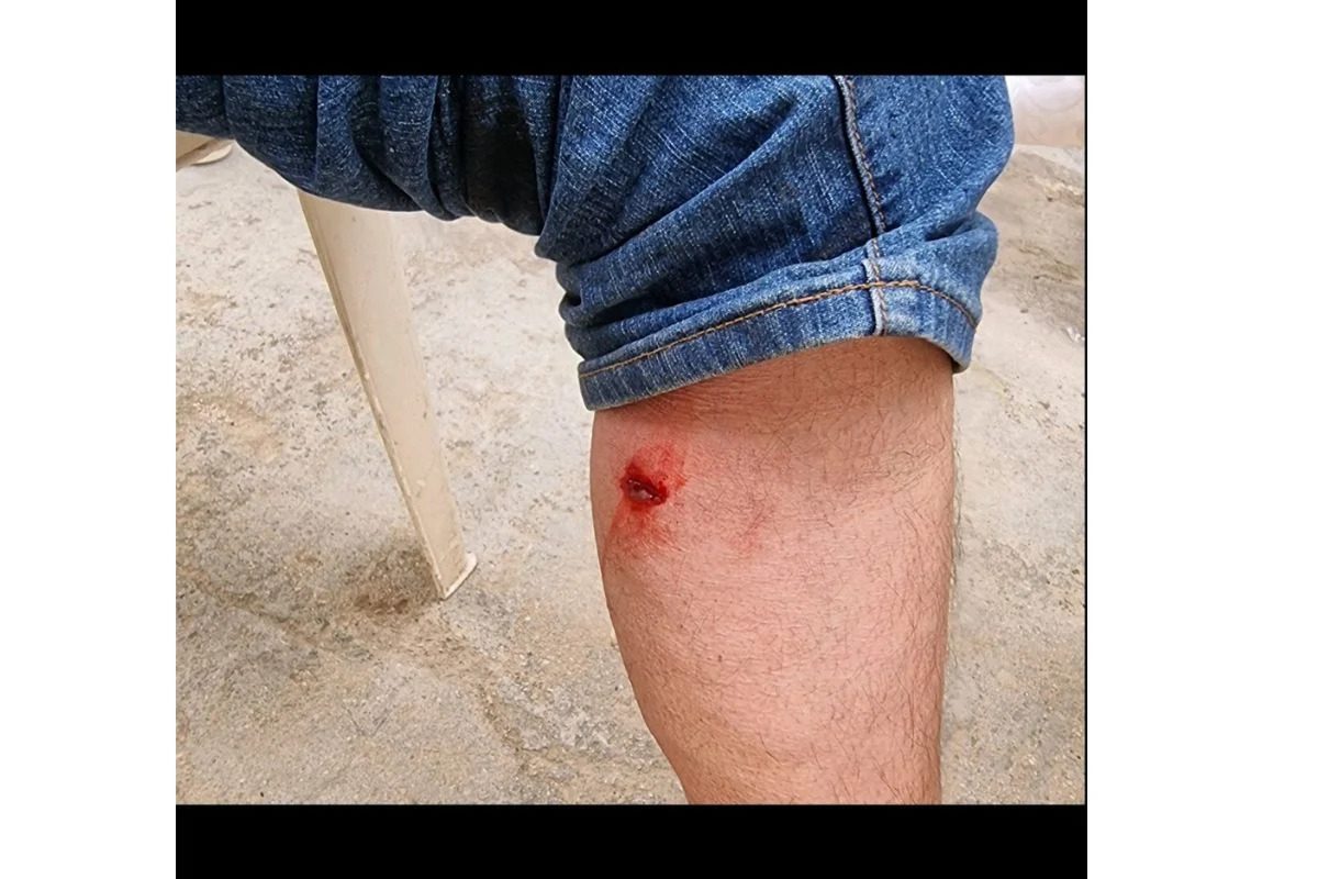 Φαρ Γουέστ η δυτική Αττική: Άνθρωπος τραυματίστηκε στο πόδι, σφαίρες σφηνώθηκαν σε αμάξια και κοντά σε σημεία που έπαιζαν παιδιά.