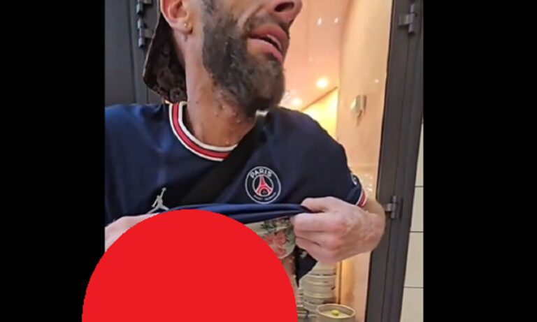 Προσοχή σκληρές εικόνες: Έτσι είναι όταν έχει ευλογιά των πιθήκων – Γάλλος κόλλησε και κυκλοφορεί με τα ΜΜΜ