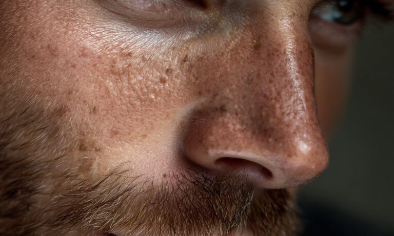 Γιατί τη μύτη μας παλιά την έλεγαν Τρίγωνο του Θανάτου;