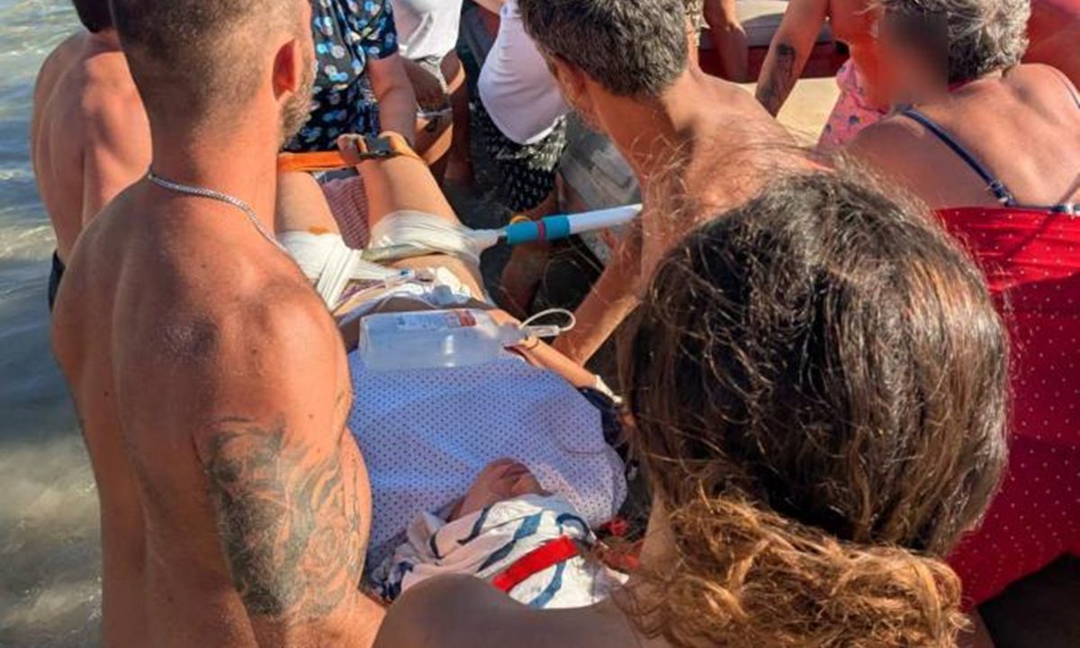 Παραλίγο τραγωδία στη Δονούσα λόγω κρατικής εγκατάλειψης – Ομπρέλα καρφώθηκε στο πόδι λουόμενης – Ανύπαρκτες οι υποδομές σε ώρα ανάγκης!