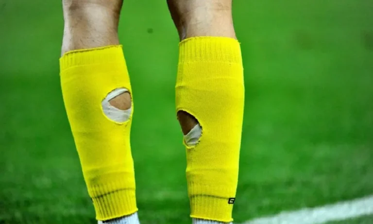 Γιατί οι ποδοσφαιριστές κάνουν τρύπες στις κάλτσες τους