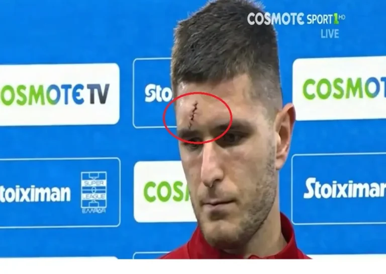 Ποδόσφαιρο: Απίστευτο το κόψιμο του Πιρόλα στο κεφάλι – Έβγαλε την γάζα και έμειναν με το στόμα ανοιχτό